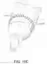 Fig. 13 - Tonometer-pachymeter apparatus for measurement of intraocular pressure