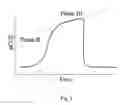 Fig. 04 - System and method for determining airway obstruction