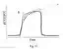 Fig. 16 - System and method for determining airway obstruction