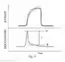Fig. 18 - System and method for determining airway obstruction