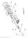 Fig. 17 - Automated biopsy and delivery device