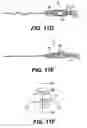 Fig. 17 - Endoscopic submucosal core biopsy device
