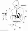 Fig. 01 - Extending intrabody capsule