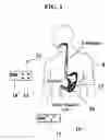 Fig. 02 - Extending intrabody capsule