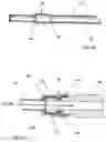 Fig. 07 - Squitieri hemodialysis and vascular access systems