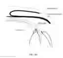 Fig. 07 - Glaucoma implant device