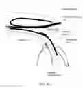 Fig. 09 - Glaucoma implant device
