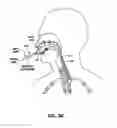 Fig. 40 - Methods and devices for non-invasive cerebral and systemic cooling