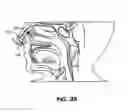 Fig. 43 - Methods and devices for non-invasive cerebral and systemic cooling