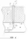 Fig. 04 - Vascular wound closure device and method