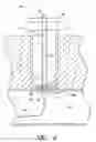 Fig. 06 - Vascular wound closure device and method