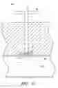 Fig. 08 - Vascular wound closure device and method