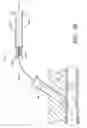 Fig. 30 - Vascular wound closure device and method