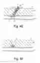 Fig. 07 - Apparatus and methods for sealing a vascular puncture