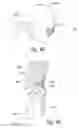 Fig. 09 - Systems and methods for directing valves that control a vacuum applied to a patient