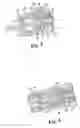 Fig. 04 - Medication injector apparatus with drive assembly that facilitates reset