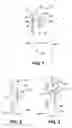 Fig. 02 - Controlled evacuation ostomy appliance