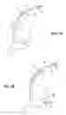 Fig. 02 - INSTRUMENT ASSISTED ABDOMINAL ACCESS