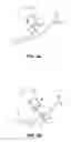 Fig. 03 - INSTRUMENT ASSISTED ABDOMINAL ACCESS