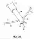 Fig. 05 - INSTRUMENT ASSISTED ABDOMINAL ACCESS