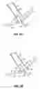 Fig. 06 - INSTRUMENT ASSISTED ABDOMINAL ACCESS