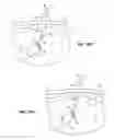 Fig. 22 - INSTRUMENT ASSISTED ABDOMINAL ACCESS
