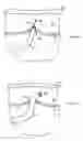 Fig. 33 - INSTRUMENT ASSISTED ABDOMINAL ACCESS