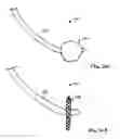 Fig. 34 - INSTRUMENT ASSISTED ABDOMINAL ACCESS