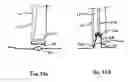 Fig. 44 - INSTRUMENT ASSISTED ABDOMINAL ACCESS
