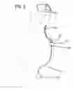 Fig. 04 - Implantable drug delivery pump