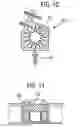 Fig. 08 - Implantable drug delivery pump