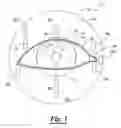 Fig. 02 - Method for treating ocular disorders