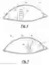 Fig. 04 - Method for treating ocular disorders