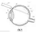 Fig. 05 - Method for treating ocular disorders