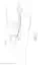 Fig. 03 - Endovenous laser treatment for varicose veins