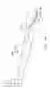 Fig. 07 - Endovenous laser treatment for varicose veins