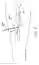 Fig. 09 - Endovenous laser treatment for varicose veins