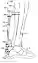 Fig. 01 - Trauma joint, external fixator and associated method