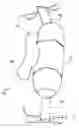 Fig. 02 - Trauma joint, external fixator and associated method