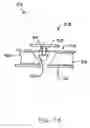 Fig. 06 - Trauma joint, external fixator and associated method