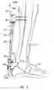 Fig. 08 - Trauma joint, external fixator and associated method