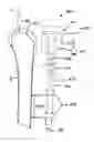 Fig. 33 - Trauma joint, external fixator and associated method