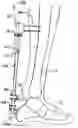 Fig. 01 - Orthopaedic joint, device and associated method