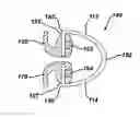 Fig. 01 - Laminar hook spring
