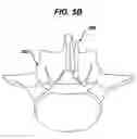 Fig. 07 - Laminar hook spring