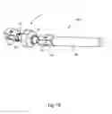 Fig. 17 - System and method for dynamic vertebral stabilization