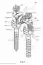 Fig. 22 - System and method for dynamic vertebral stabilization