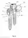 Fig. 27 - System and method for dynamic vertebral stabilization
