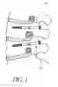 Fig. 02 - Method and apparatus for spinal fixation