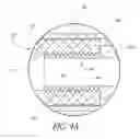Fig. 04 - Method and apparatus for spinal fixation